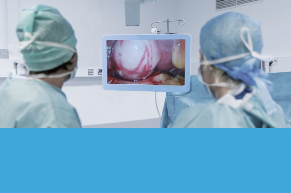 Endoscopy 2D to 3D